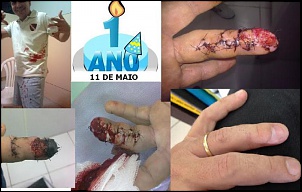 Rapaziada potiguar-dedo-1-ano.jpg