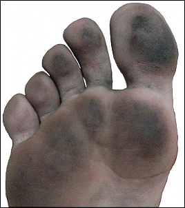 -dirty-foot.jpg